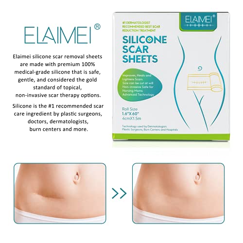 Medical Grade Silicone Scar Sheets