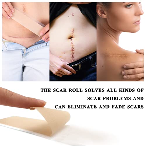 Medical Grade Silicone Scar Sheets