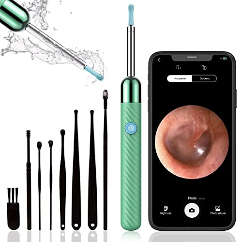 Wireless Microscope Camera,1080P Ear Camera Microscope, Ear Cleaner with Camera