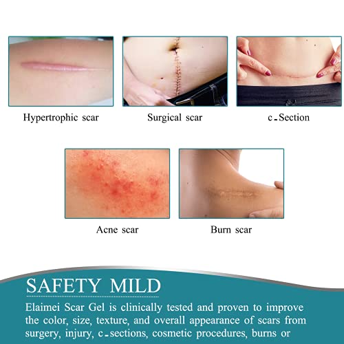 Medical Grade Silicone Scar Sheets