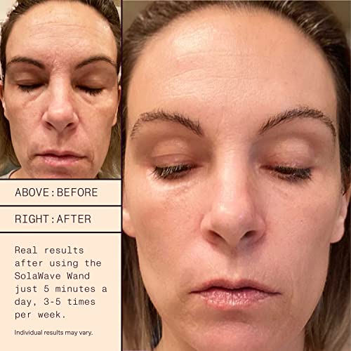 SolaWave 4-in-1 Facial Wand