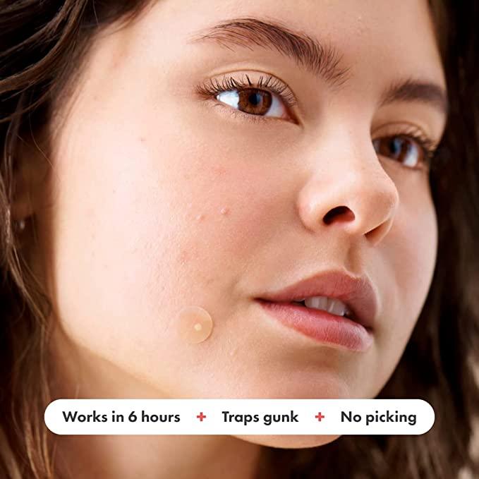Mighty Patch for Acne and Pimples