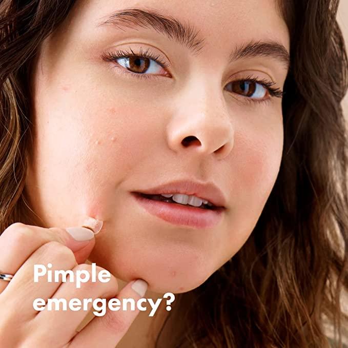 Mighty Patch for Acne and Pimples