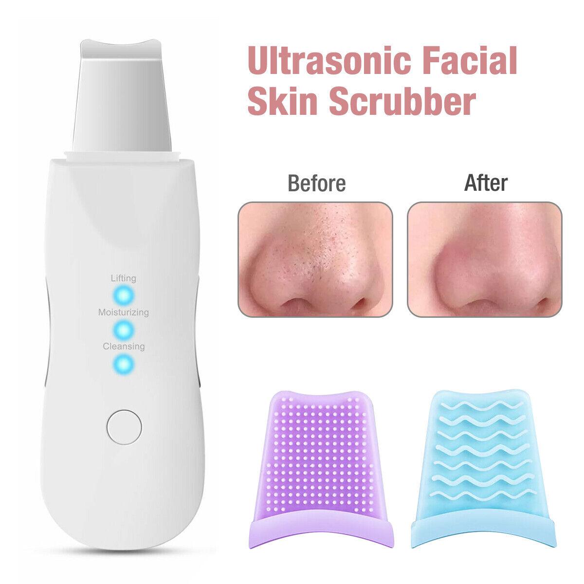 Ultrasonic Skin Scrubber with Pore Cleaner